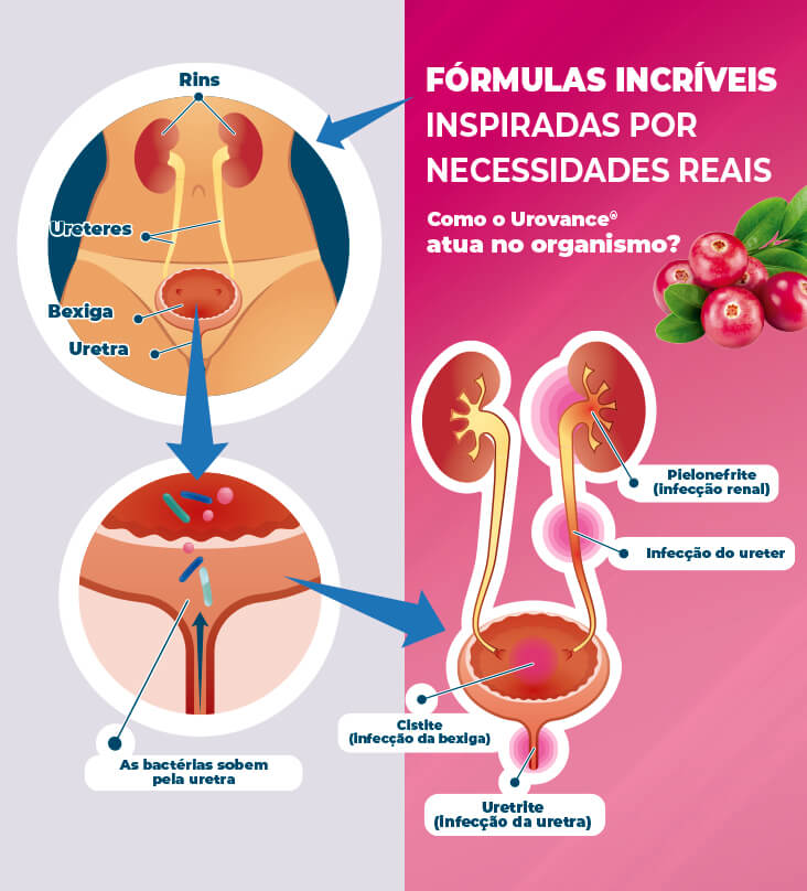 Urovance® e Infecções Urinárias